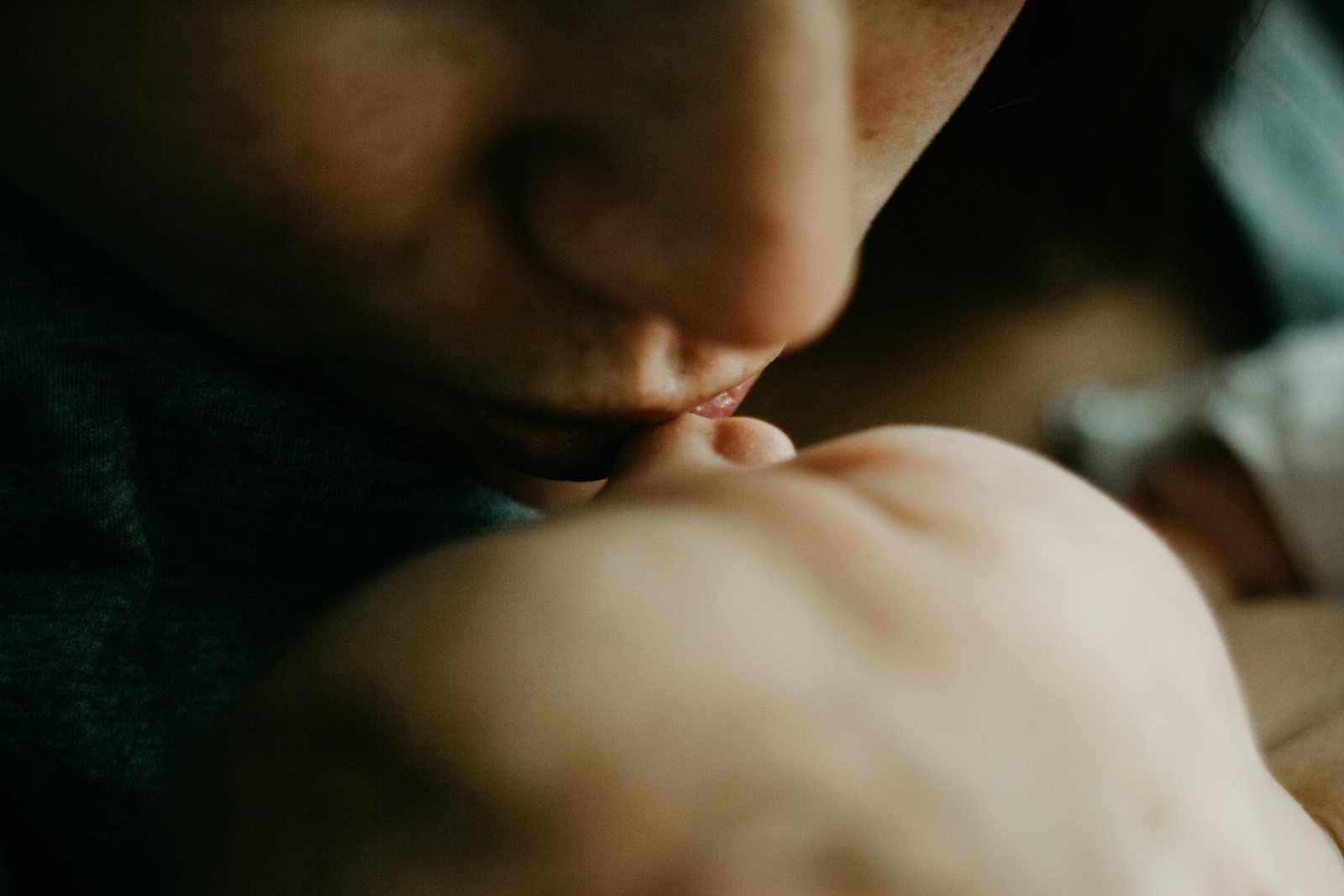 Can Kisses Cause Baby Acne