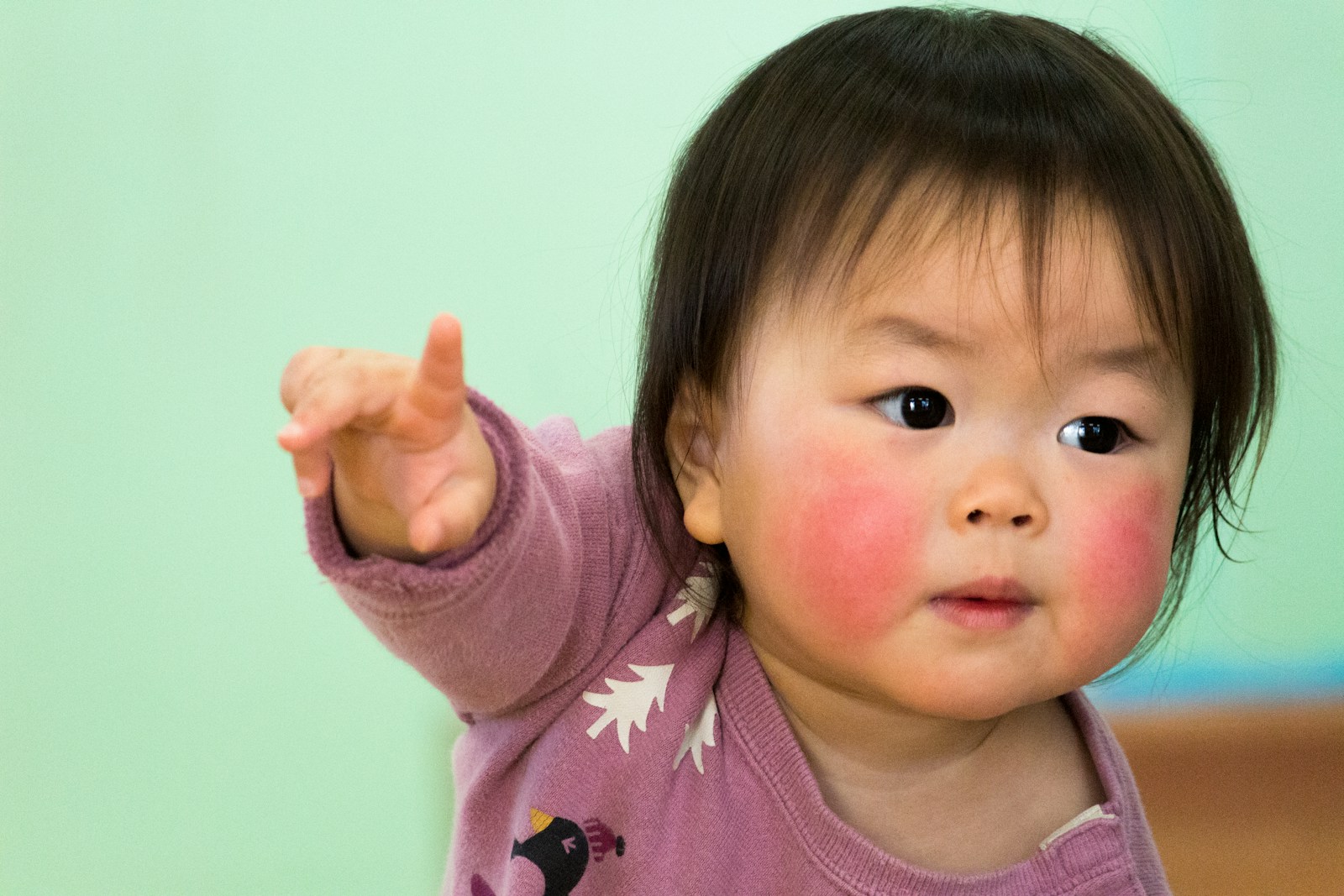 Can Babies Get Shingles