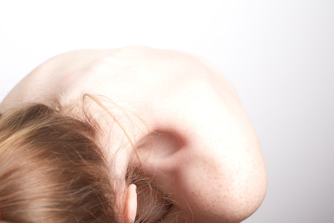 Can Babies Get Concussions related image