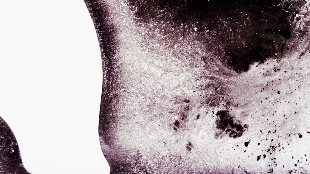 Can Babies Get Shingles related image